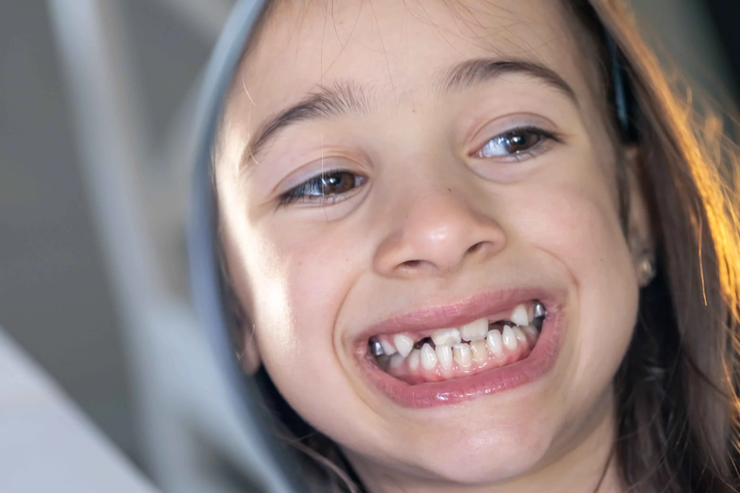 Uneven Wear on Teeth, and other difficulties in chewing, and teeth alignment are indicators that your child needs early orthodontic treatment